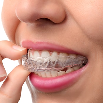 Invisalign is an orthodontic solution to straight teeth without metal brackets and wires.