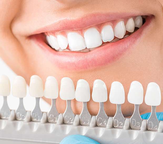 Troy Cosmetic Dentist