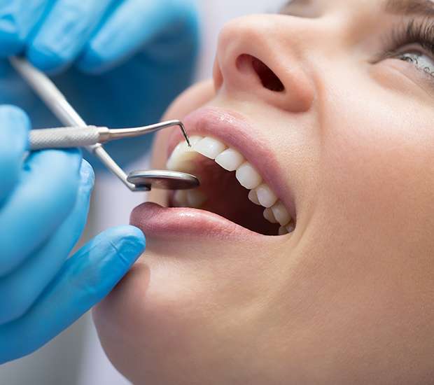 Troy Dental Bonding