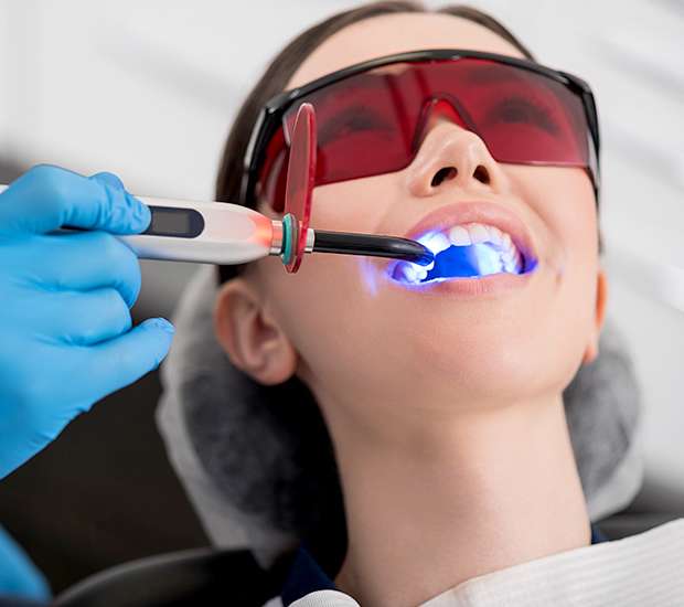 Troy Professional Teeth Whitening