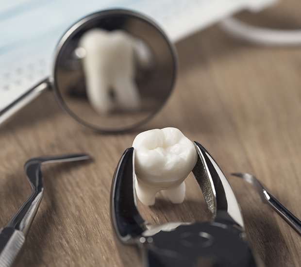 Troy When Is a Tooth Extraction Necessary